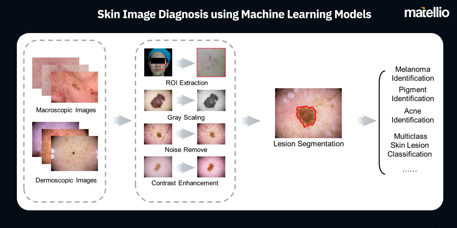Skin Image Diagnosis using Machine Learning Models