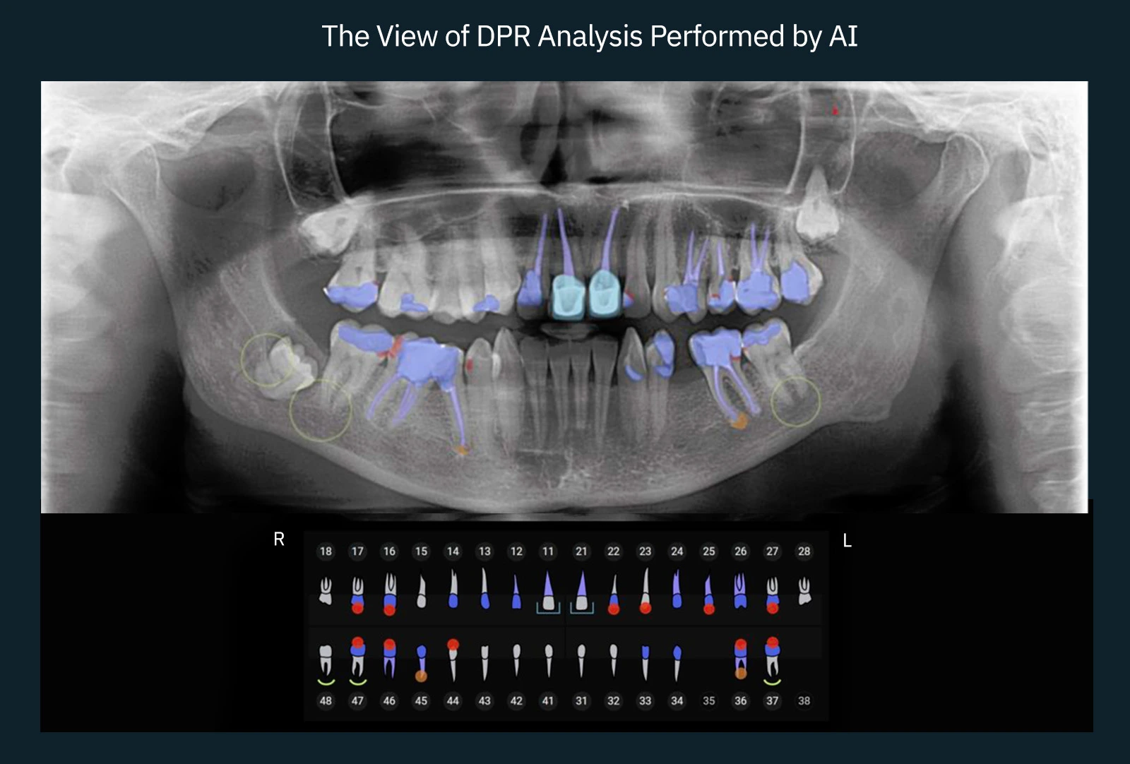 The View of DPR Analysis Performed by AI 